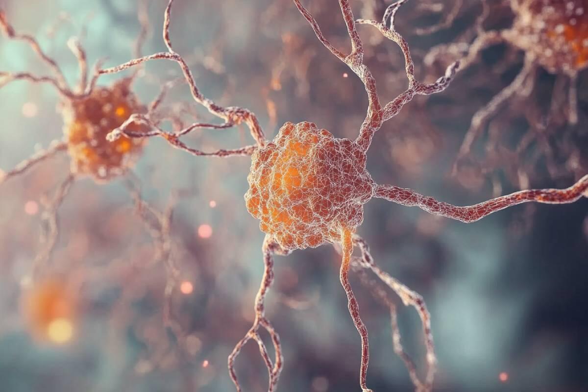 Parkinson: Avanços Recentes na Pesquisa Genética